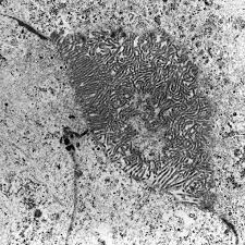 No electron microscopy was done on the original biopsy. Http Eknygos Lsmuni Lt Springer 266 Part 20six 6 20item Pdf