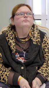 Tammy Slaton Skin Removal Update