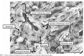 Related posts of cross section of human bone diagram. Distinguishing Between Human And Non Human Bones Histometric Method For Forensic Anthropology Semantic Scholar