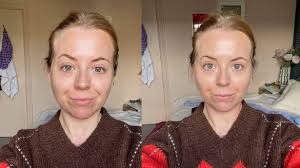 I broke my arm, but I still scoffed a kebab before going to hospital