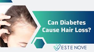 Inflammation or scarring is not usually present. Can Diabetes Cause Hair Loss Estenove Hair Transplant