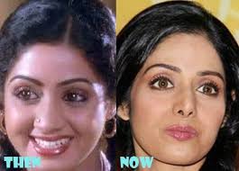 Aishwarya Rai Shilpa Shetty Sridevi Priyanka Chopra Kareena Kapoor Like These Celebrities Anyone Can Improve Their Look By Undergoing Nose Reshaping At M Atores At the same time, it's crucial to remind them the need to sanitise and maintain social distance in these times till we have a vaccine.😥 we shot this before the pandemic (hence, no masks) but fitness will be and must be relevant at all times in our lives. aishwarya rai shilpa shetty sridevi