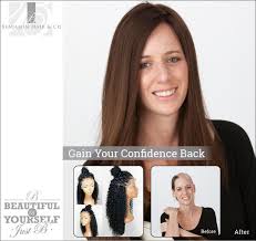 For some people, trichotillomania may be mild and generally manageable. Human Hair Wigs For Trichotillomania Covering Up Trich