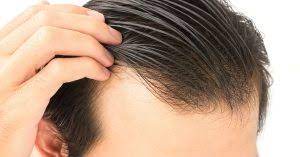 While severe iron deficiency anemia can cause. Can Anemia Impact My Hair Loss Rhrli