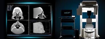 Image result for Sinus CT