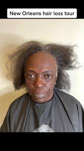 While in New Orleans this beauty came in wanting a makeover. She saw so  many women being set free with the same conditions as her. Watch until the  end to see how beautiful she is embracing her own ...