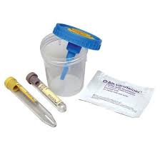 Bd 364956 Vacutainer Urine Collection Kit Is A Sterile Urine Specimen Collection System Complete With A Conical Tube Medical Supplies Urinal Cancer Screening