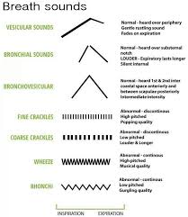 simplified breath sounds chart for nurses nursing