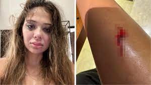 Merve Taşkın Haberleri - Merve Taşkın Kimdir - Haberler