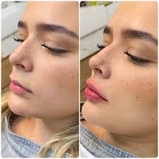 Bem-vindos a clínica Dra. Lorena Miranda! Um espaço feito com todo o  carinho para cuidar de você e realçar a sua beleza! Aqui, acreditamos que a  harmonização facial vai muito além da