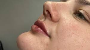 Nurse Al's Aesthetics