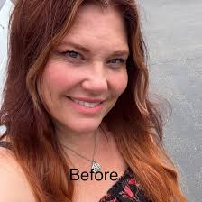 Grateful to highlight her remarkable beauty with #EspinoLift — where  precision meets elegance. She kindly shared her own photos to show her  journey. #nomakeup just her own beauty! Don't forget to follow