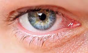 Coastal eye institute is an ophthalmology practice with eye doctors specializing in the areas of cataract, lasik, retina, glaucoma and pediatrics. Glaucoma City Eyes Ophthalmic Opticians