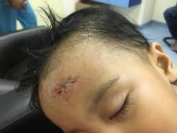 Ada juga perkataan sinonim dan berkaitan dengannya ada dipaparkan di sini. Jatuh Air Muka Saya In English