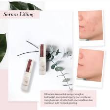 Kemasan serum luminous ms glow asli dan palsu. Perbedaan Serum Lifting Dan Luminous Ms Glow Tips Membedakan
