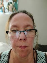 Hello all, I'm not so sure if this is allowed.. My husband has been  recently diagnosed with lupus.. I've already lost a sister through lupus  and I just pray every day that