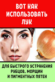 как избавиться от пигментных пятен на лице в домашних условиях Vot Kak Ispolzovat Luk Dlya Bystrogo Ustraneniya Rubcov Morshin I Pigmentnyh Pyaten Health And Beauty Skin Care Face Care