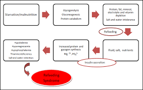 Image result for Refeeding Syndrome