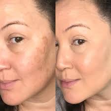 💎𝚂𝙴𝙸𝙽𝚃 𝐌𝐚𝐭𝐮𝐫𝐞-𝐒𝐤𝐢𝐧 𝙼𝙰𝙺𝙴𝚄𝙿 and Riman Skincare By  Jewel💎