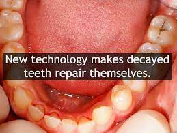 How to fix a rotten tooth. New Technology Makes Decayed Teeth Repair Themselves Intelligent Living