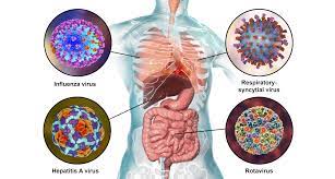 Most babies have been infected at least once by the time they are 2 years old. Rs Virus Der Haufigste Ausloser Schwerer Pneumonien Bei Kindern