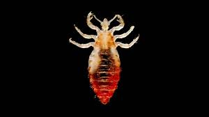 Image result for pubic lice symptoms