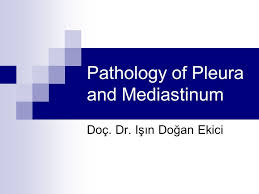 As mentioned above, one of the most difficult differential diagnostic problems with pleural dmm is separating epithelial dmm from reactive mesothelial proliferations, and separating sarcomatoid dmm from fibrous pleuritis. Pathology Of Pleura And Mediastinum Ppt Video Online Download