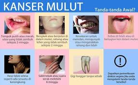 Ulser di bibir atau lidah satu perkara yang amat biasa berlaku menyebabkan rasa sakit, pedih dan kemerahan di kawasan terlibat. Klinik Lathika Kota Sarang Semut Ulser Yang Tidak Sembuh Selepas 2 Minggu Kesukaran Menelan Atau Mengunyah Tahukah Anda Ia Kemungkinan Kanser Mulut Kanser Mulut Merupakan Ketumbuhan Tisu Yang Tidak Normal