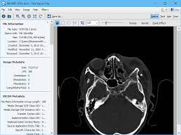 These applications help you view dicom records of quite a lot of types in extraordinary ways. Open Nema Dcm And Dicom Files