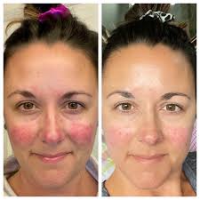 Farmasi Dr. C Tuna Acne Cleanser review