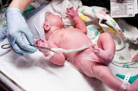 During your baby's first few weeks, while the umbilical cord stump is still attached, you should only give sponge baths. How To Bathe Newborn With Umbilical Cord Www Qyamtec Com