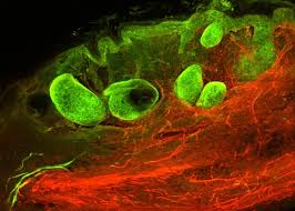 A World without Scars