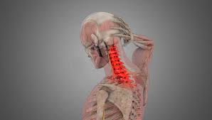Pero no sólo las mochilas y los bolsos pueden perjudicar las cervicales. Cervicalgia Shimspine