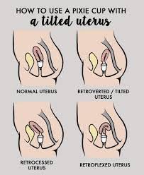 High cervix diagram menstrual cup. How Do I Use A Menstrual Cup With A Tilted Uterus Pixie Cup