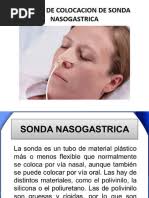 Sonda Nasogastrica 2