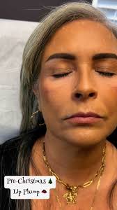 Get yourself what you really want for Christmas 🎄❤️ Fuller lips & wrinkle  free 💁🏻‍♀️ message us for booking holiday specials ✨ Vela Wellness and  follow our new page for updates and transformations ...