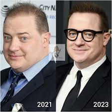 Brendan Fraser's recent glow up is absolutely fabulous! He looks amazing!  Check out that hairline and that glowing skin! If you want a Brendon Fraser  worthy hairline & skin glow up, consider
