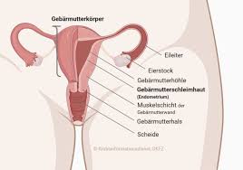 Ein großteil der betroffenen hat keine beschwerden. Gebarmutterkorperkrebs Endometriumkarzinom Symptome Diagnose Behandlung Und Leben Mit Der Erkrankung