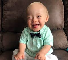 We did not find results for: The Real Down Syndrome Problem The Denver Post