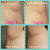 Ingrown Hair Serum European Wax Center