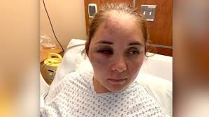 Get the best deals on cute 13 year old dresses and save up to 70% off at poshmark now! Mom Brutally Attacked By 13 Year Old Boy Who Told Her Son To Go Back To Mexico Ktxs