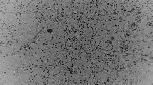 It was first identified in december 2019 in wuhan,. Doherty Institute Scientists First To Grow And Share 2019 Novel Coronavirus