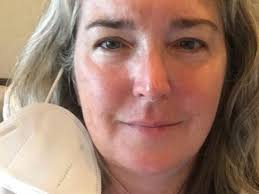 Fundraiser by Alyssa-Tori Alexander : Help Melinda Complete Brain  Treatments