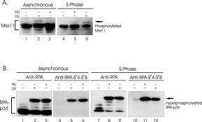 It is quite important that you protect your family install the detector base into the wall: Replication Protein A And The Mre11 Rad50 Nbs1 Complex Co Localize And Interact At Sites Of Stalled Replication Forks Journal Of Biological Chemistry