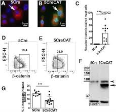 Merits medical register information and technical system (merits). Frontiers Cell Intrinsic Deregulated Ss Catenin Signaling Promotes Expansion Of Bone Marrow Derived Connective Tissue Type Mast Cells Systemic Inflammation And Colon Cancer Immunology