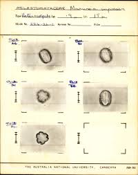 Image result for Dissotis irvingiana