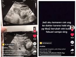 Haid tidak teratur, mulai dari gejala sampai pengobatannya. Viral Kisah Wanita Haid Tidak Teratur Pilih Usg Sendirian Ternyata