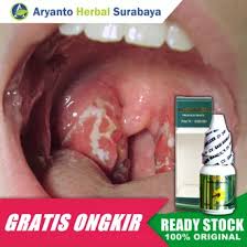 Maybe you would like to learn more about one of these? Jual Produk Obat Amandel Sakit Tenggorokan Kering Termurah Dan Terlengkap Juli 2021 Bukalapak