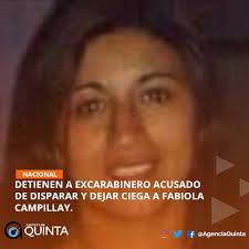 Desde entonces ha transcurrido un año. Agencia Quinta Auf Twitter Nacional La Brigada Dd Hh De La Pdi Detuvo En Curico Al Excapitan De Carabineros Patricio Maturana Quien Habria Disparado La Bomba Lacrimogena Que Dejo Ciega A Fabiola Campillay