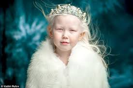 The exact colour depends on how much melanin their body produces. Snow White The Eight Year Old Siberian Albino Daily Mail Online